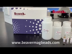 De Stabiliteit van RNAkit extract nucleic acid excellent van de BeaverBeadskruk